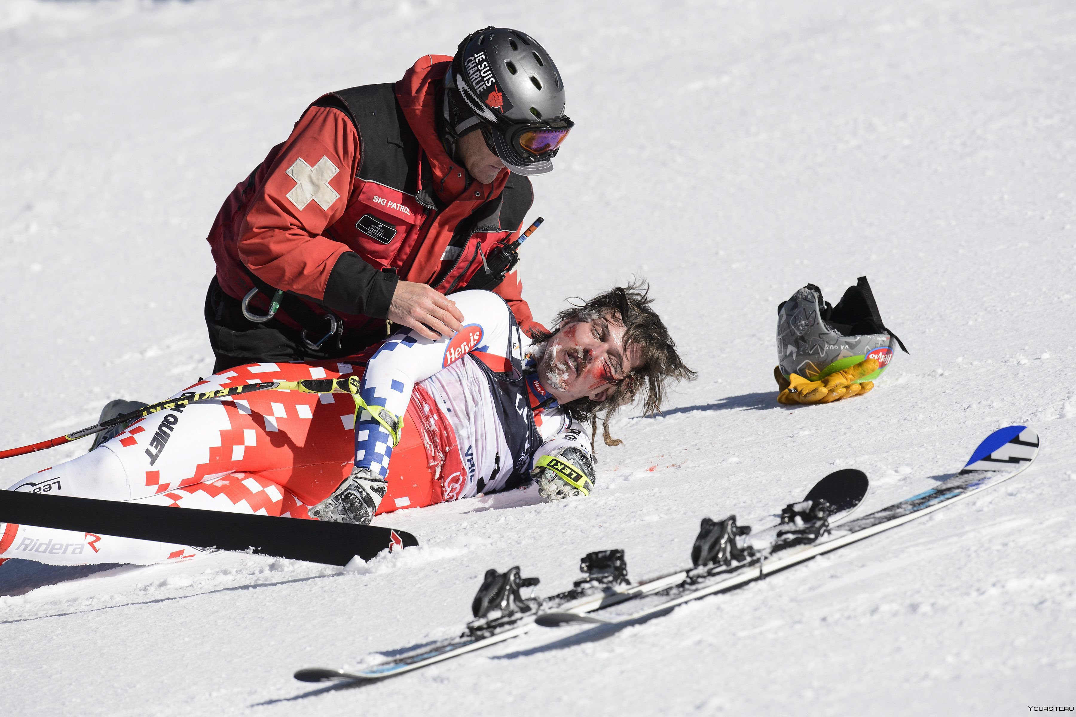 Упавший лыжник. Травмы в горнолыжном спорте. Травмы на горных лыжах.