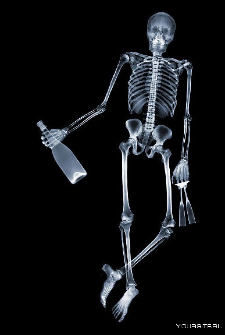 Рентгеновский снимок человека