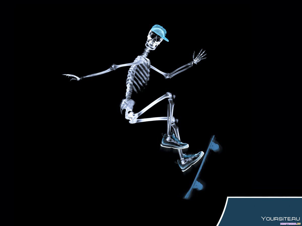 Скелеты рентген танец маленьких лебедей