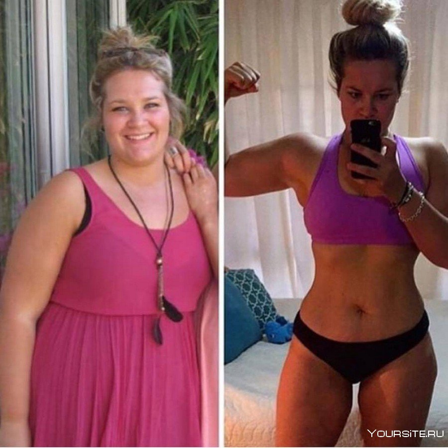 Экстремальное похудение до и после