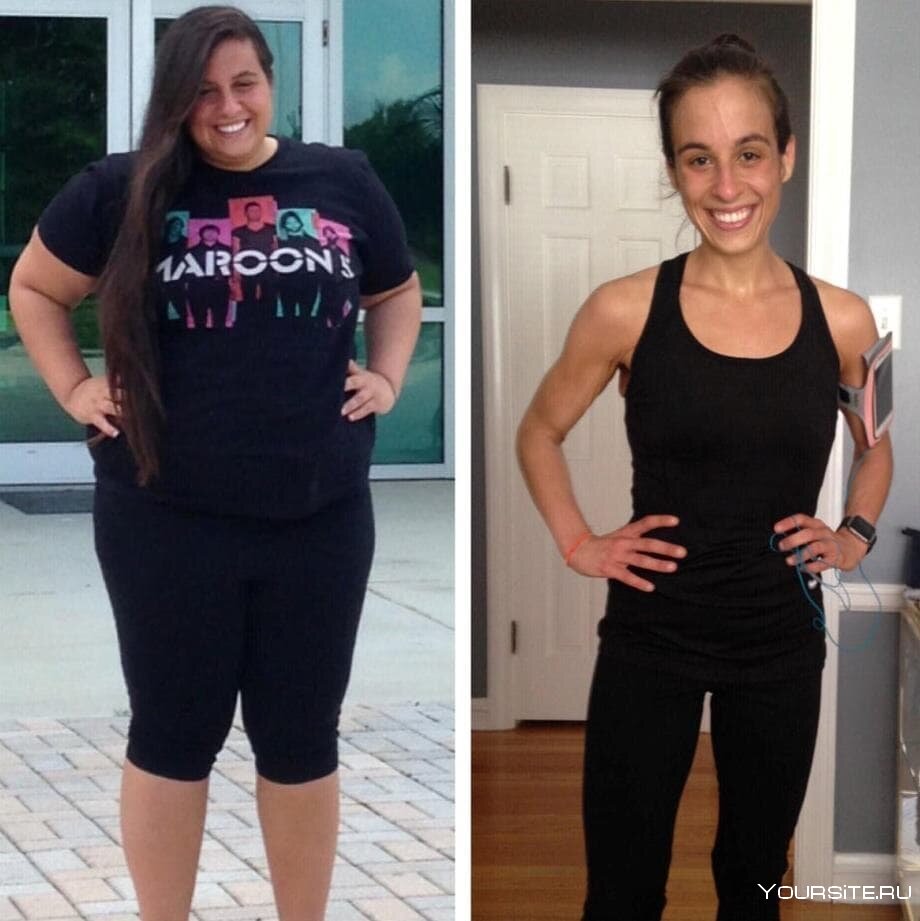 Экстремальное похудение до и после