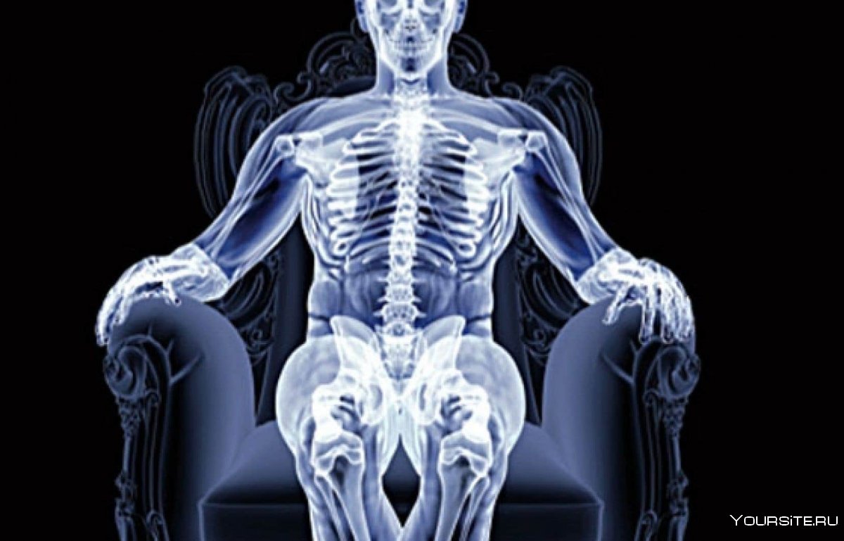 Рентген скелета человека фото