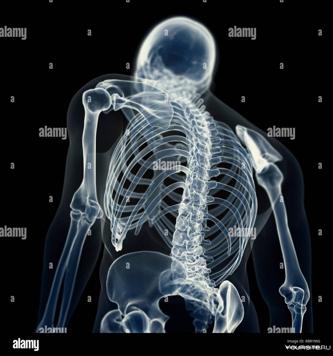 Рентген костей человека