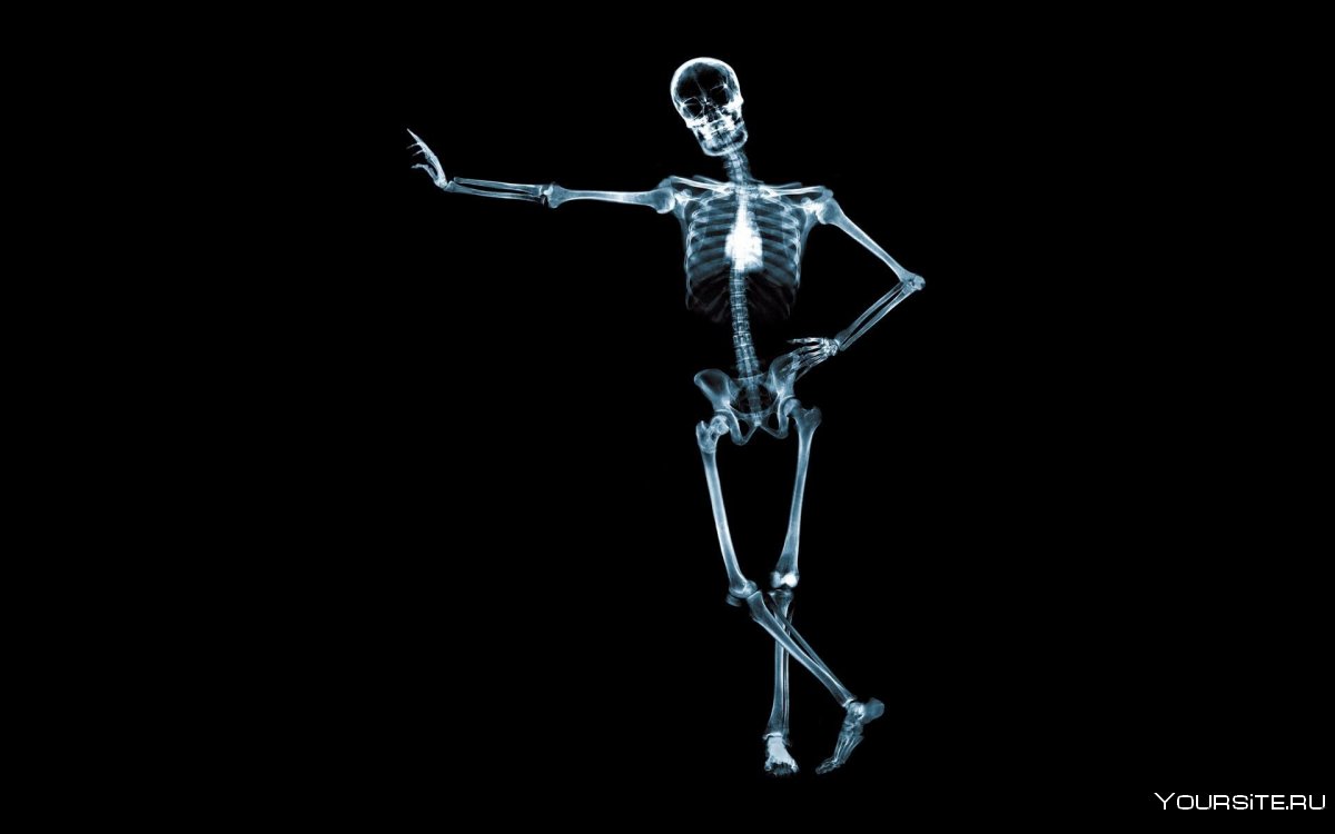 Рентген человека