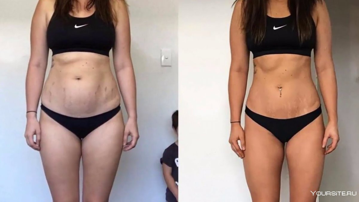 Похудение до и после
