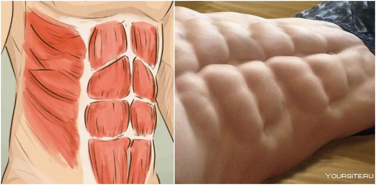 Поперечная мышца живота (m. transversus abdominis)