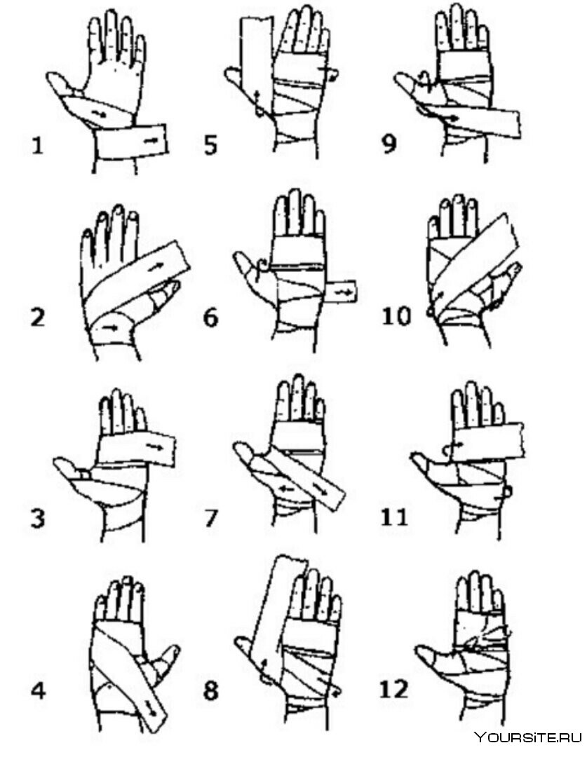 Как правильно забинтовать кисть руки марлевым бинтом
