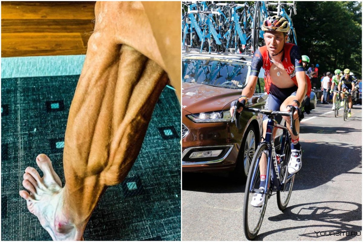 Роберт Форстеманн, велогонщик,