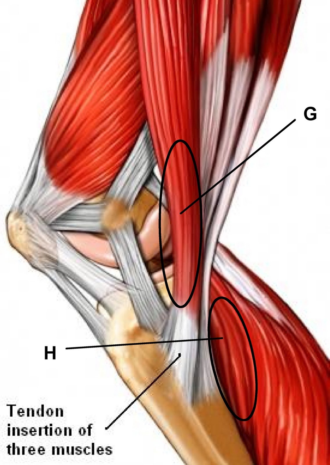 Боли в мышцах коленного сустава. Тендинит сухожилия подколенной мышцы. Гусиная лапка PES anserinus. Сухожилия гусиной лапки анатомия. Бурсит гусиной лапки коленного сустава.