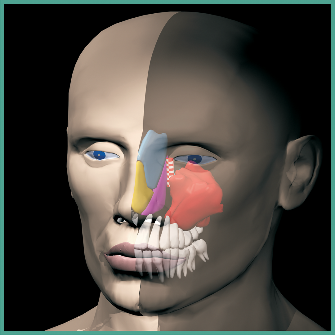 Гайморова пазуха. Гайморовы пазухи 3d модель. Анатомия гайморовой пазухи 3д. Гайморовы пазухи носа анатомия.