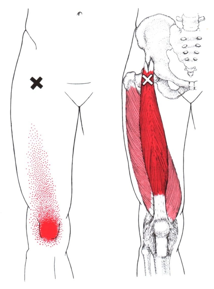 Biceps femoris