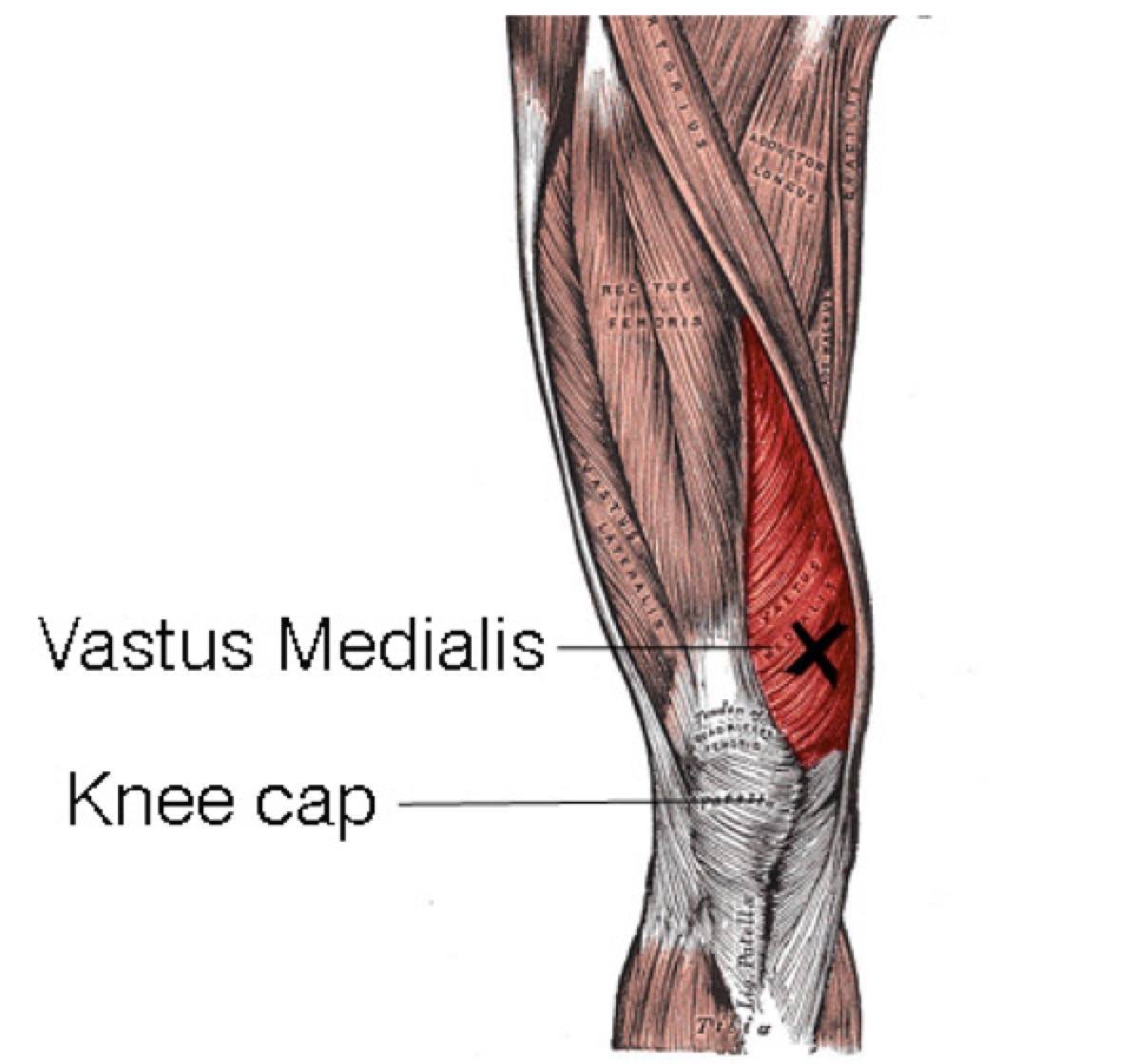 Vastus medialis мышца