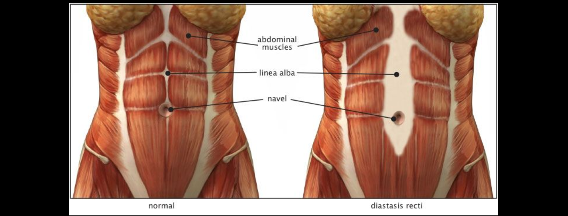 Мышцы живота у женщин фото спереди