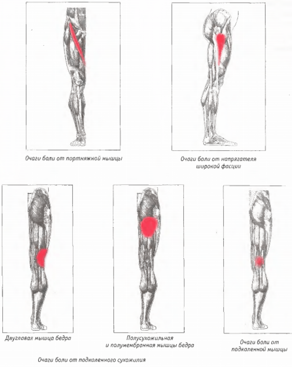 Сильные боли в области бедра. Боль в верхней части ноги от бедра до колена. Болит мышца бедра сбоку при ходьбе. Болит наружная часть бедра сбоку. Атрофия мышц внутренней поверхности бедра.