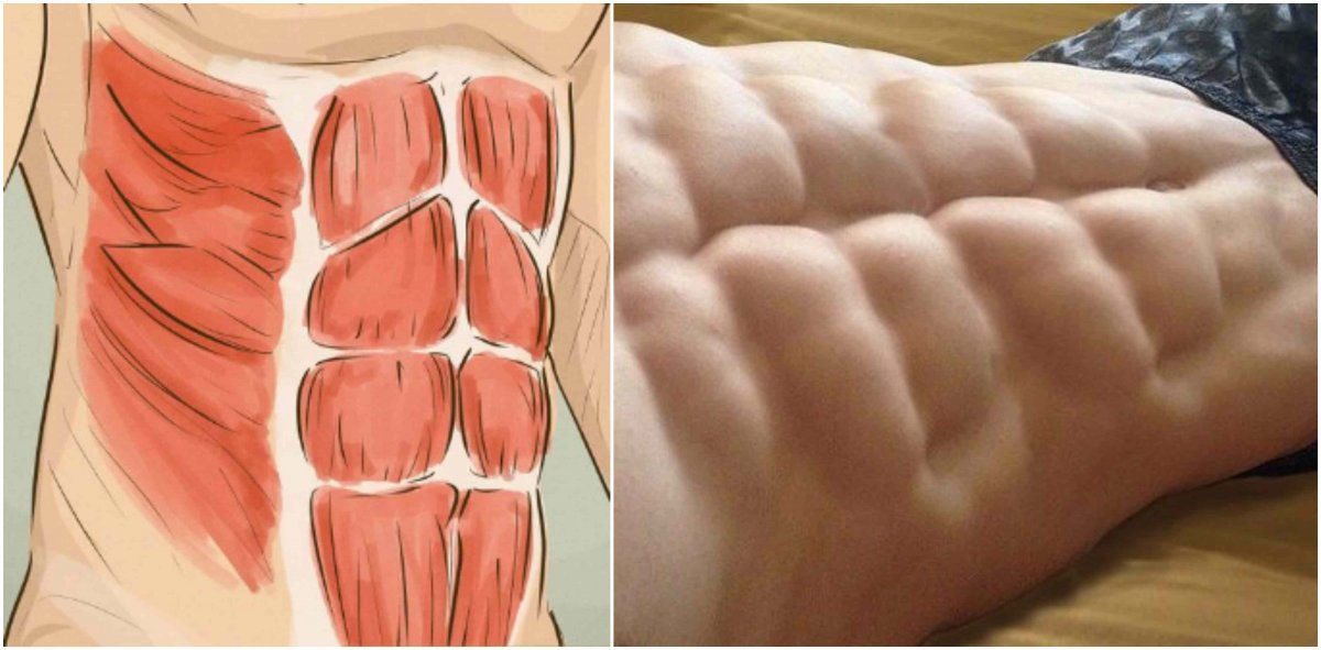 M rectus abdominis