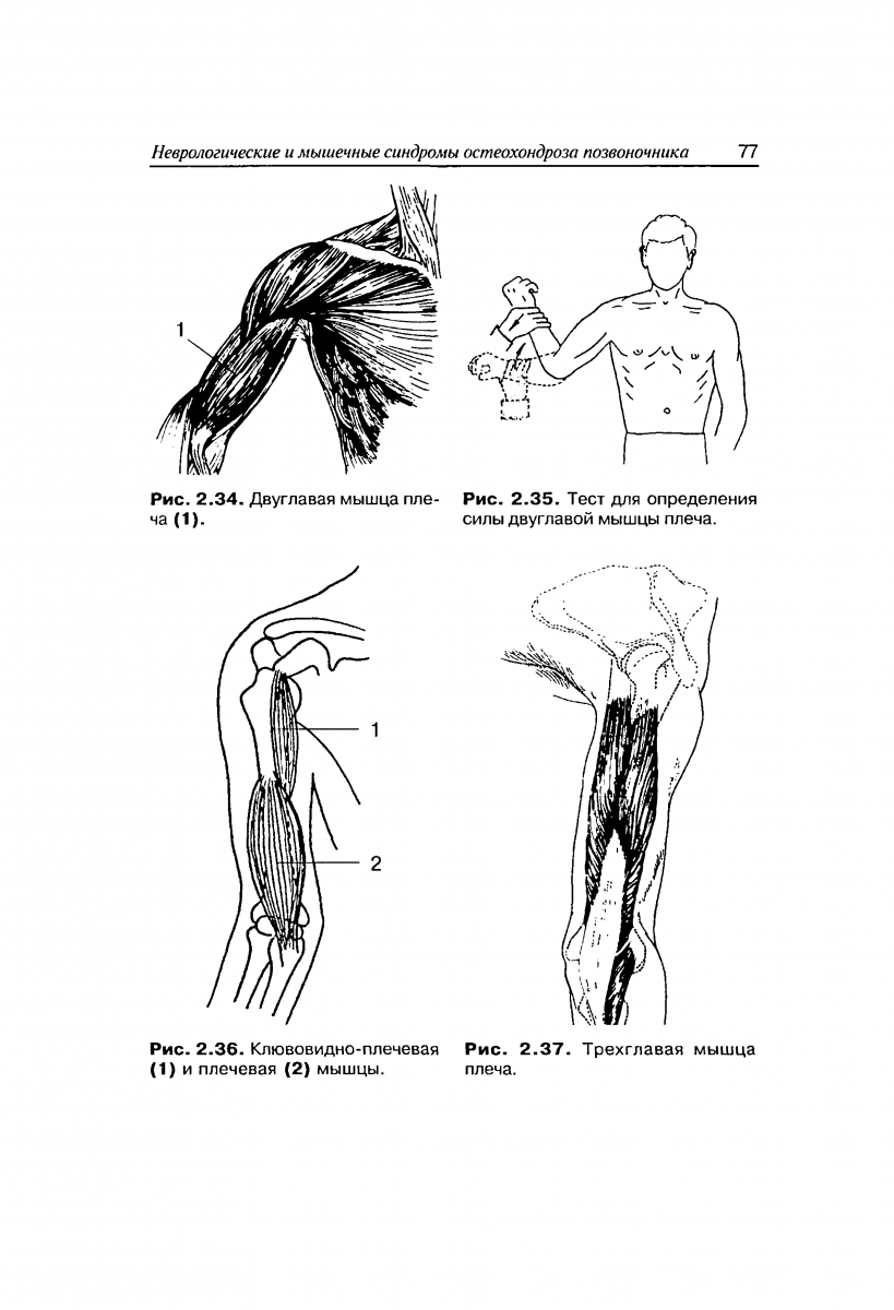 Двуглавая и трехглавая мышца плеча