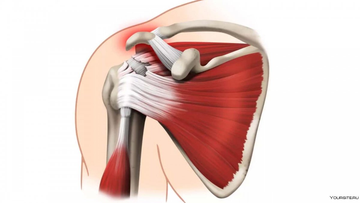 Latissimus Dorsi мышца