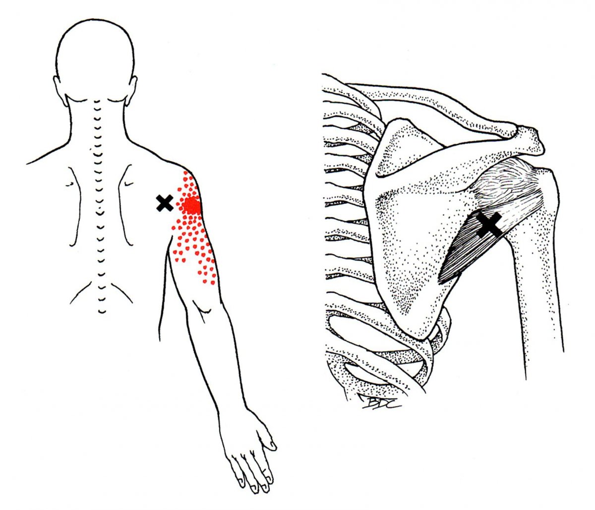 Подостная мышца плечевого сустава