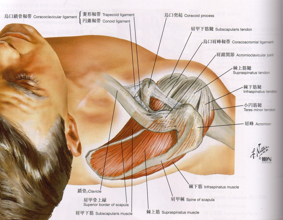 Лечение частичного разрыва мышц. Ротаторная манжета плечевого сустава. Повреждение ротаторная манжета. Ротаторная манжета плечевого сустава анатомия. Сухожилия надостной мышцы плечевого.