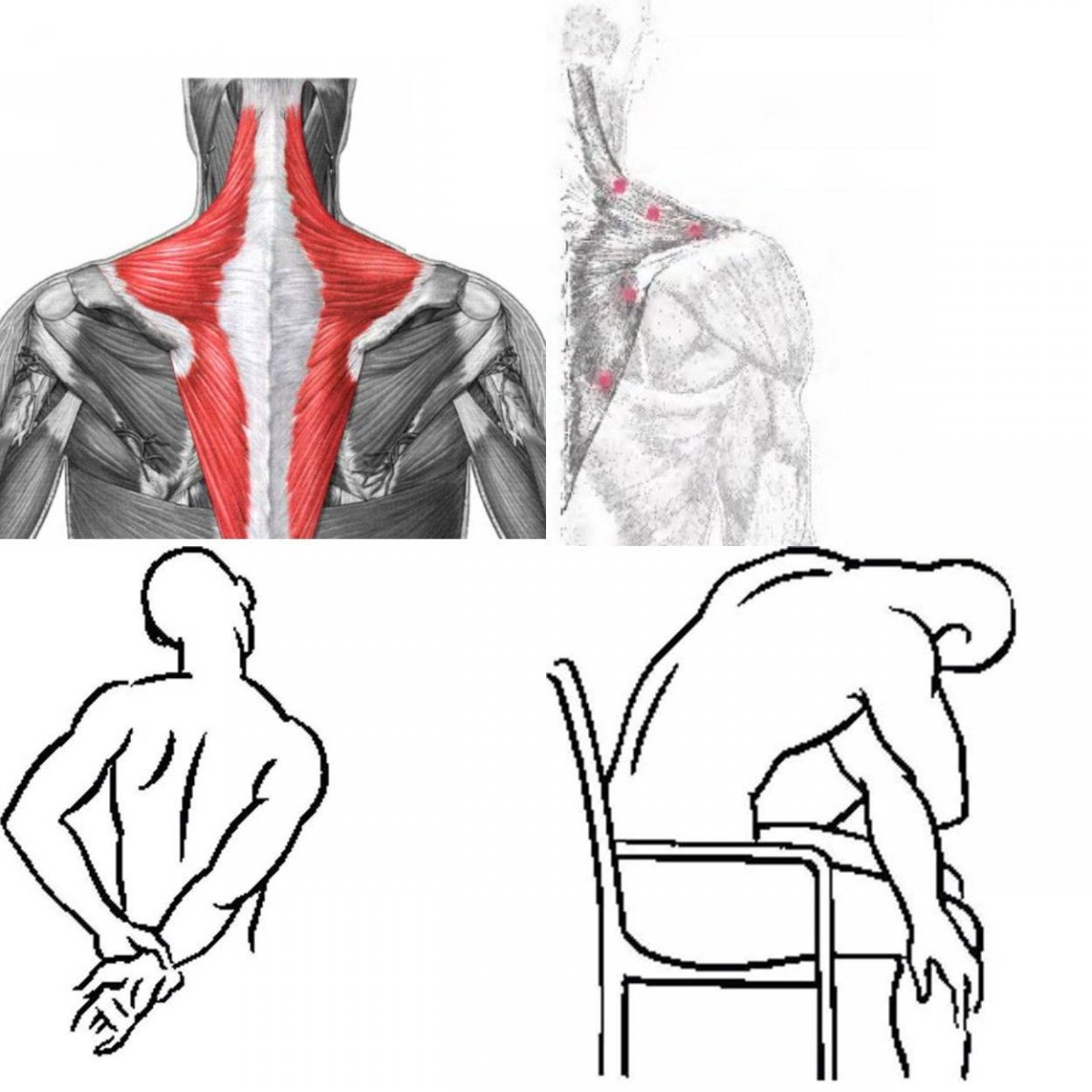 Трапеция мышцы спины