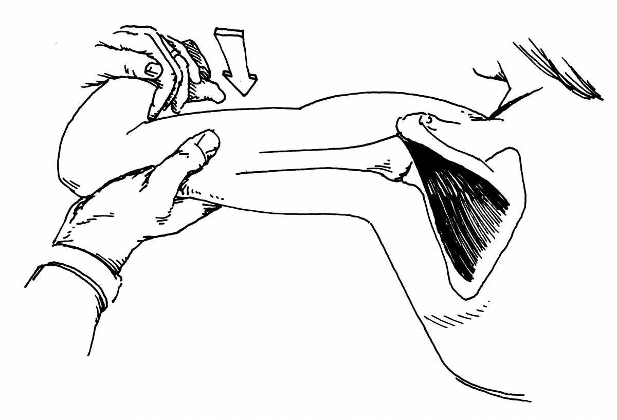 Rotator muscle анатомия