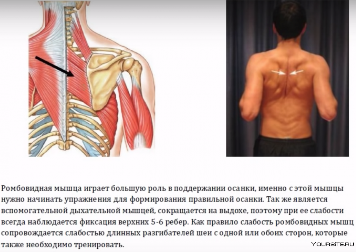 Ромбовидная мышца спины триггерные точки