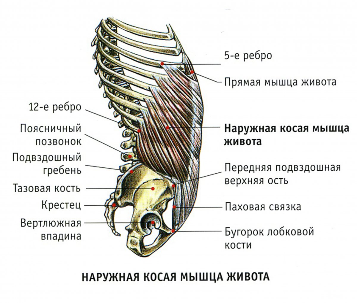 Диастаз прямой мышцы живота