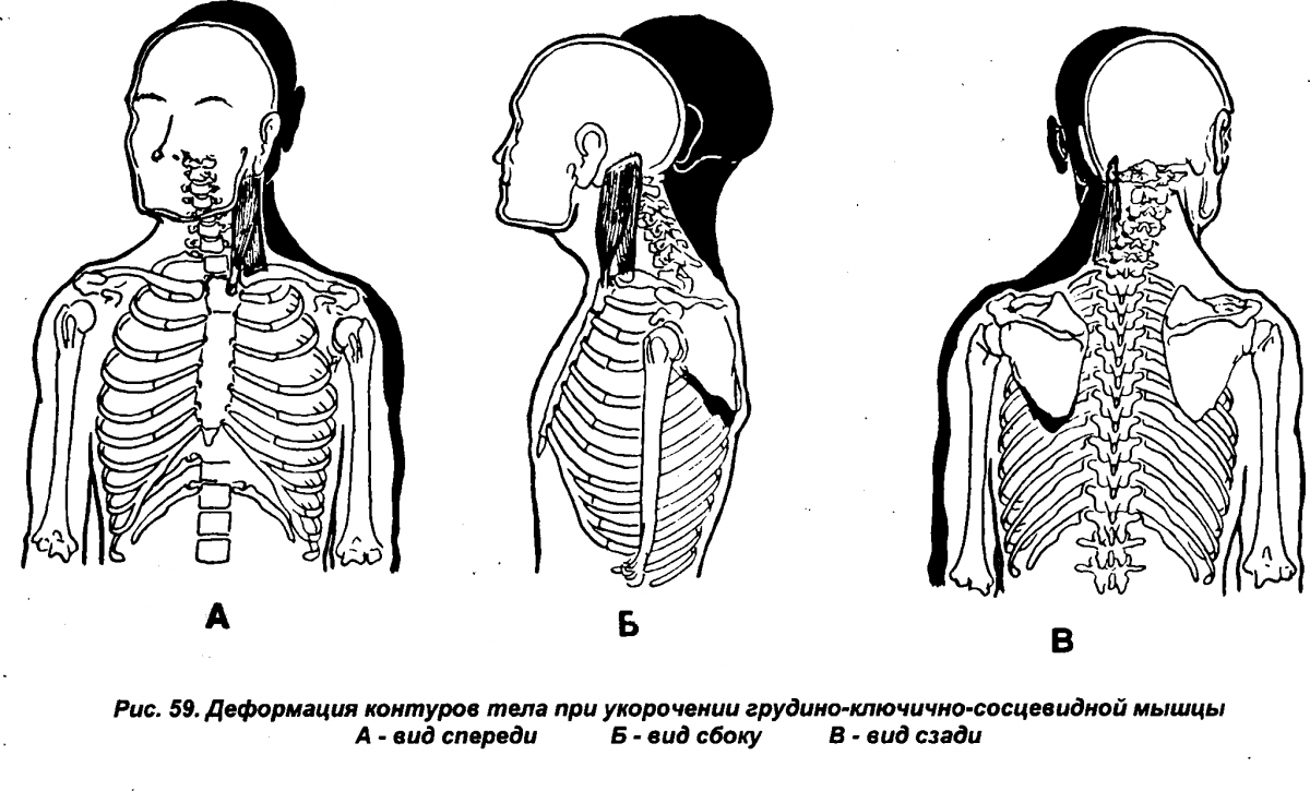 Поверхностные мышцы шеи анатомия