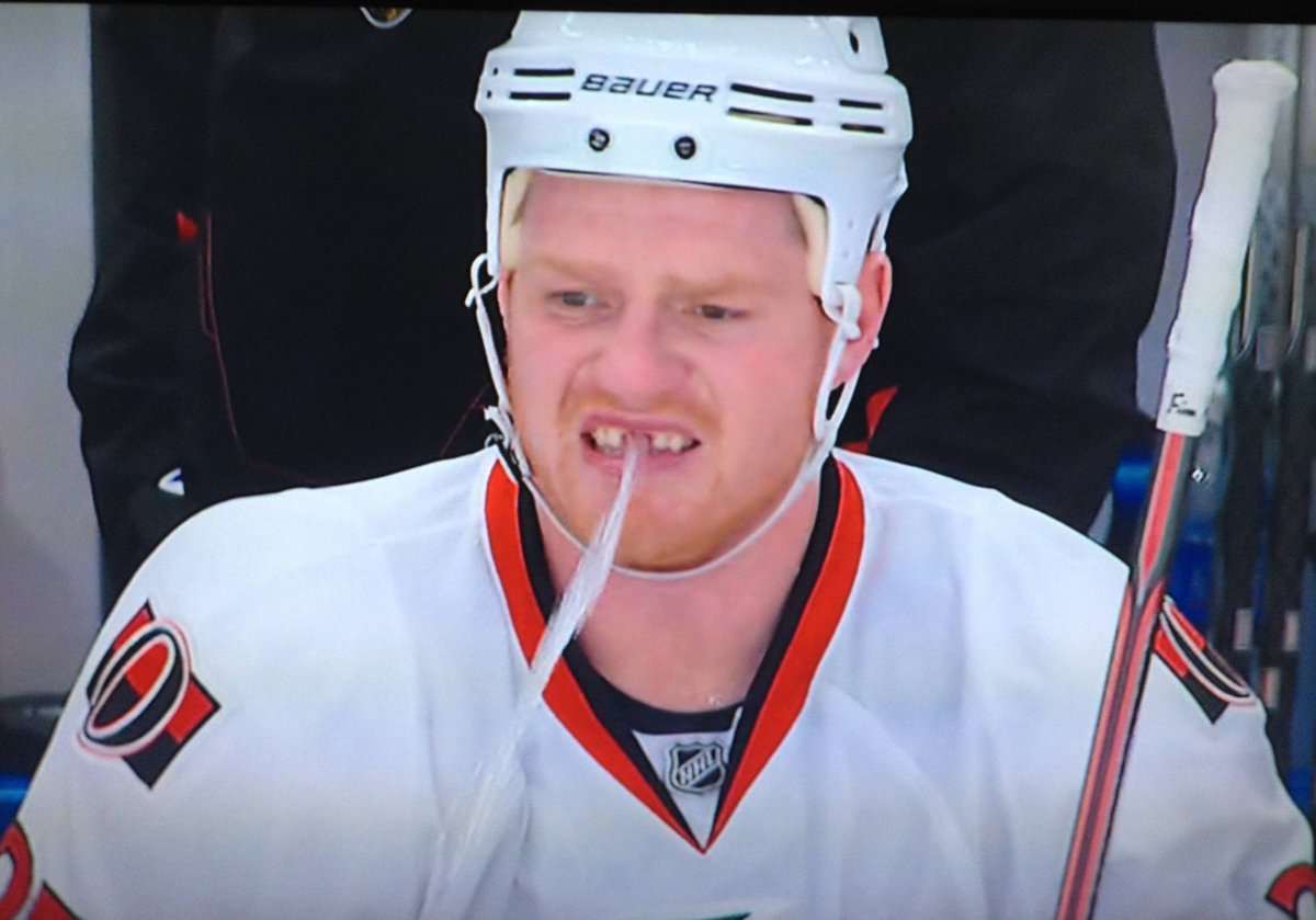 Хоккеист с шайбой в зубах