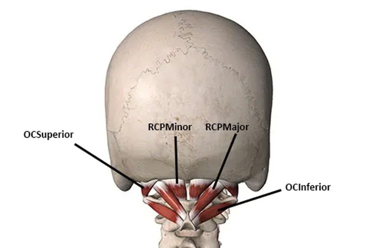 Rectus capitis posterior