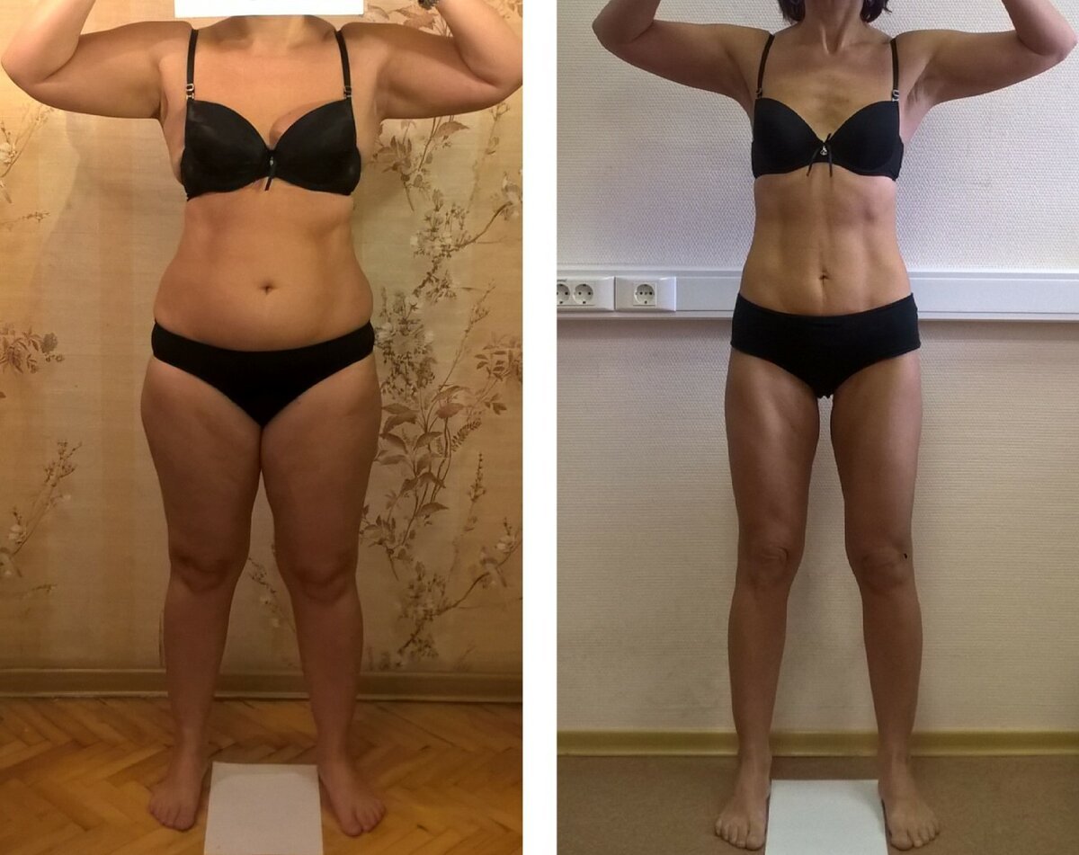 До и после похудения на 10 кг