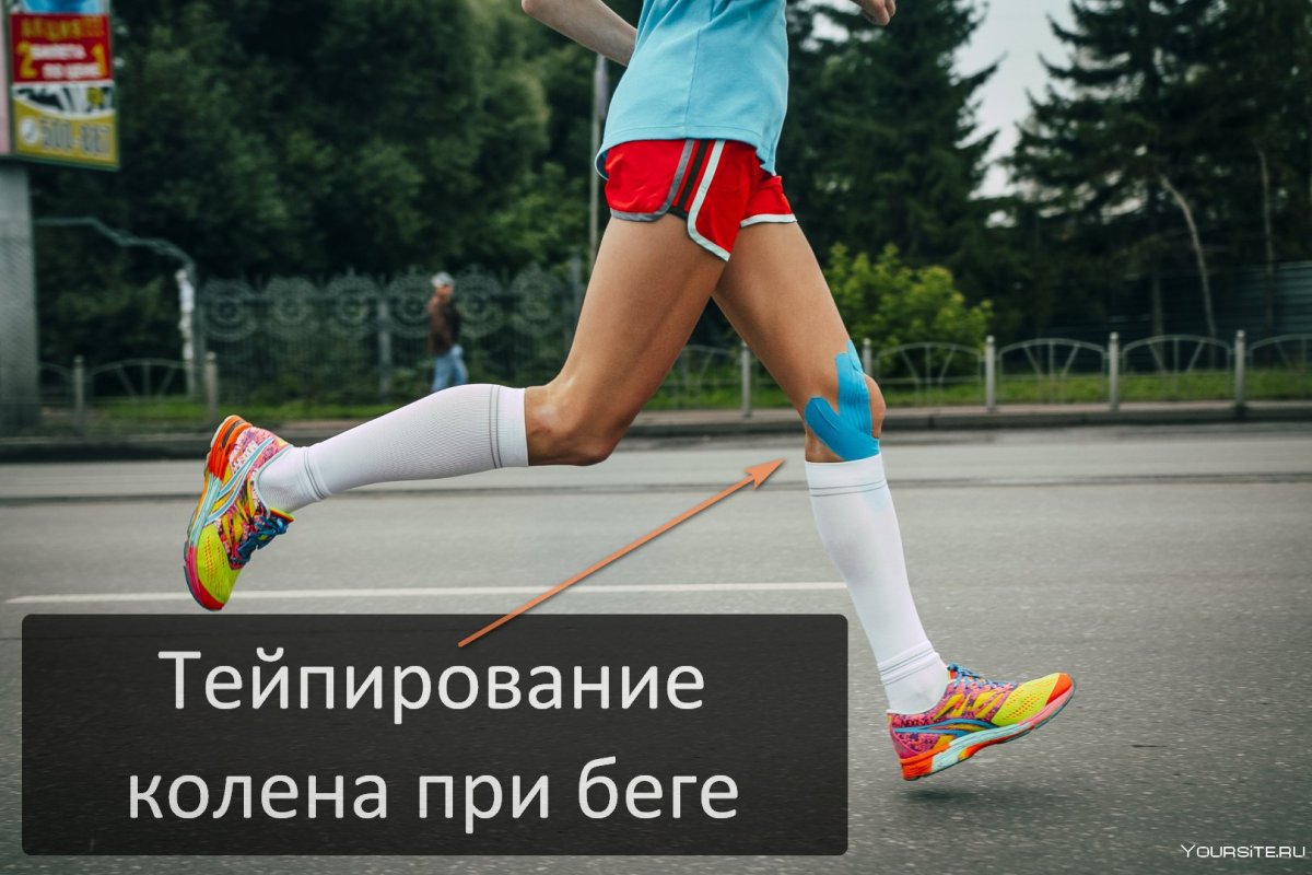 Тейпирование колена при беге