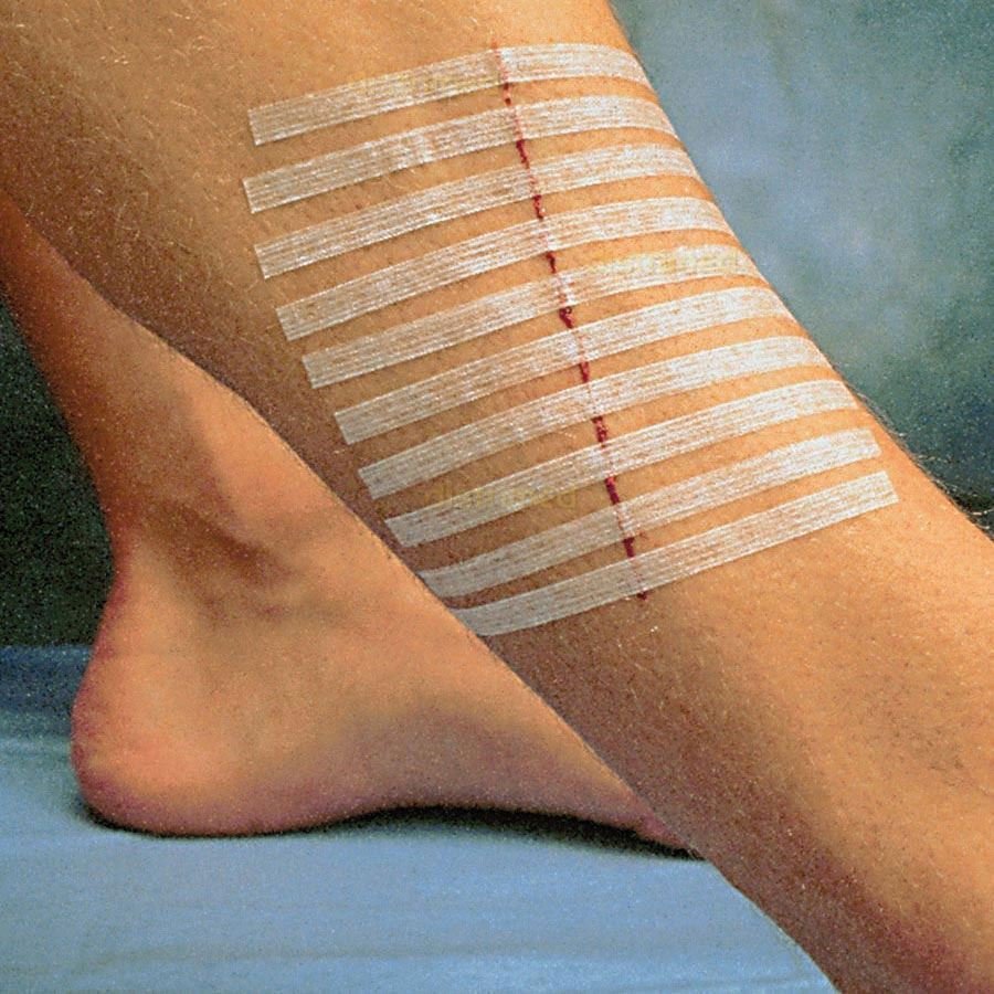 Клейкие полоски 3мтм Steri-strip