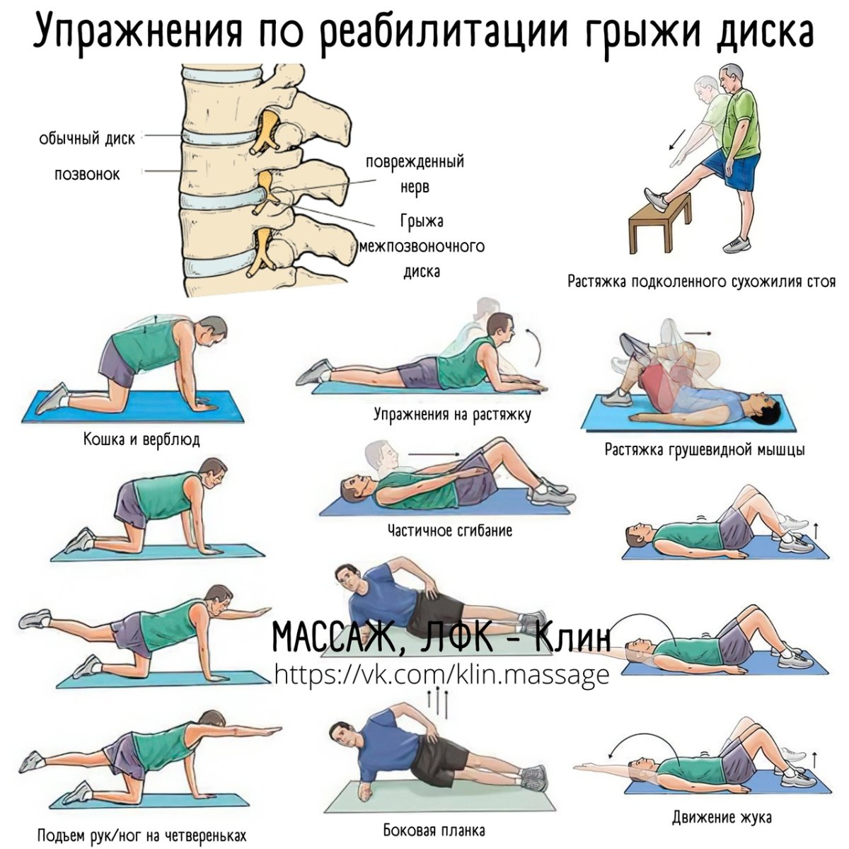 ЛФК грыжа диска д3 д4