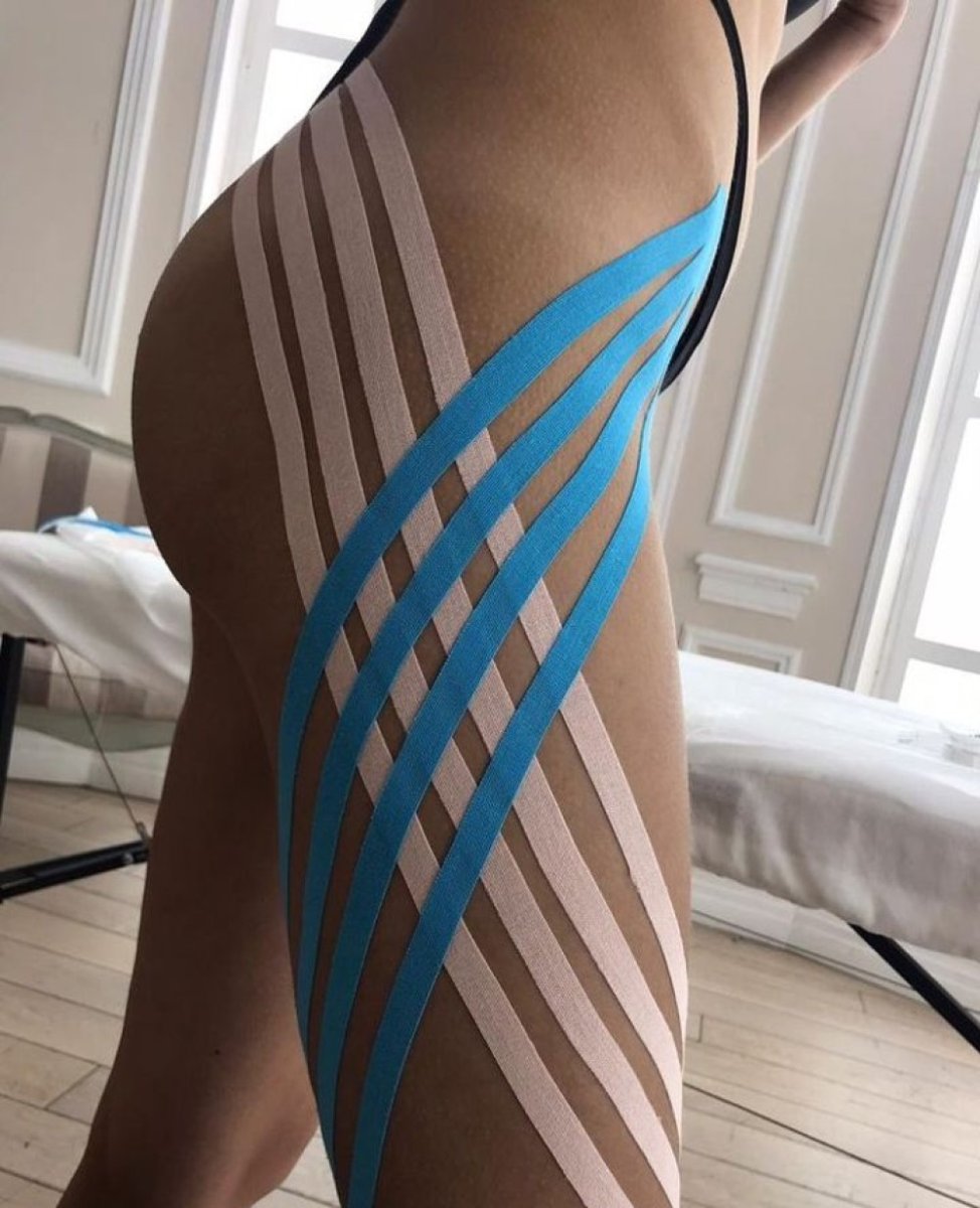 Тейпирование енко