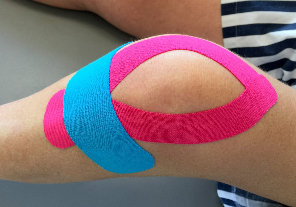 Кинезио тейп на коленный сустав